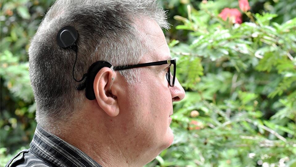 Cochlear lifts full year profit, sees more growth