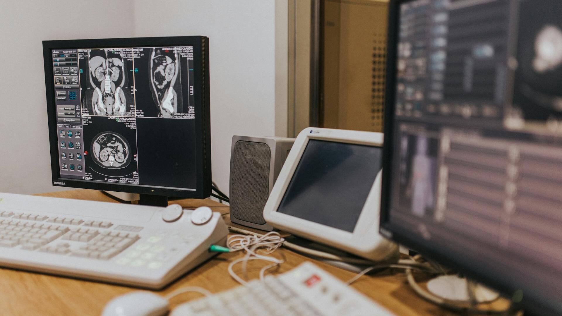 Pro Medicus half year profit soars to record